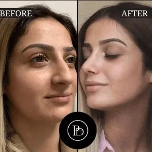 PRP Treatments in Dubai: Benefits, Results, and Costs
